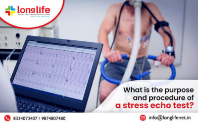 What is the purpose and procedure of a stress echo test?