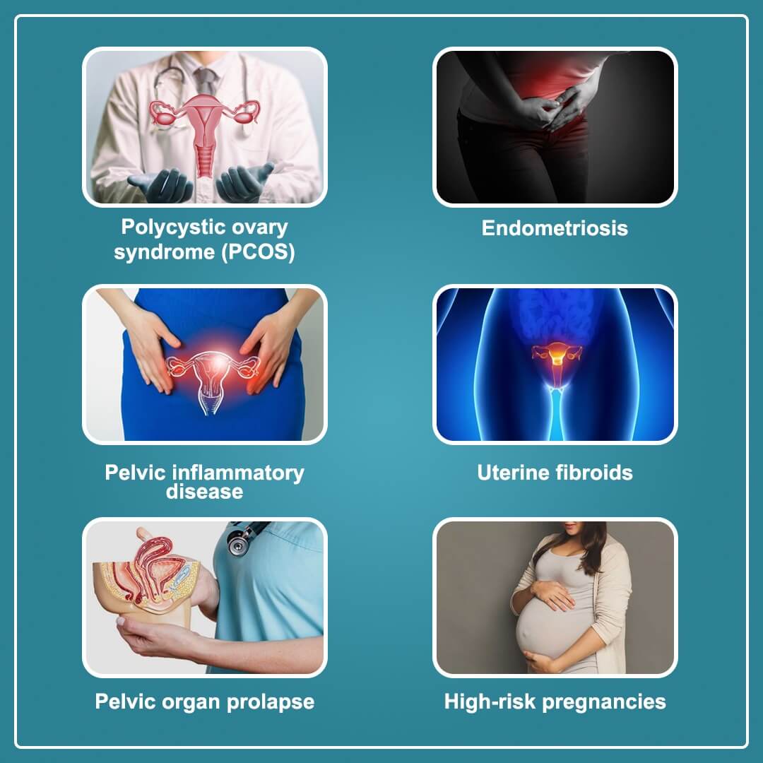 gynecological problems treatment gynecological problems treatment