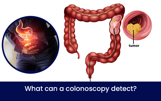 gastroenterologist doctor in mukundapur